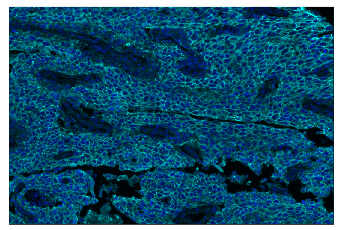 Immunohistochemistry Image 2: TACSTD2/TROP2 (F4W4J) & CO-0150-488 SignalStar<sup>™</sup> Oligo-Antibody Pair