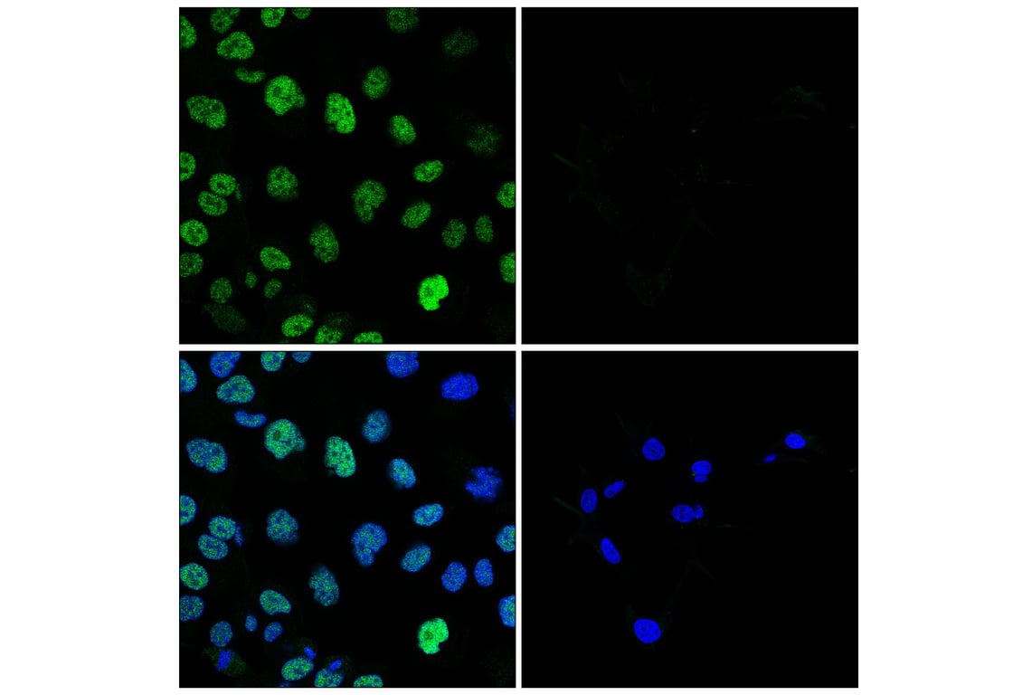 Immunofluorescence Image 1: MLLT3 (E5Z7U) Rabbit Monoclonal Antibody