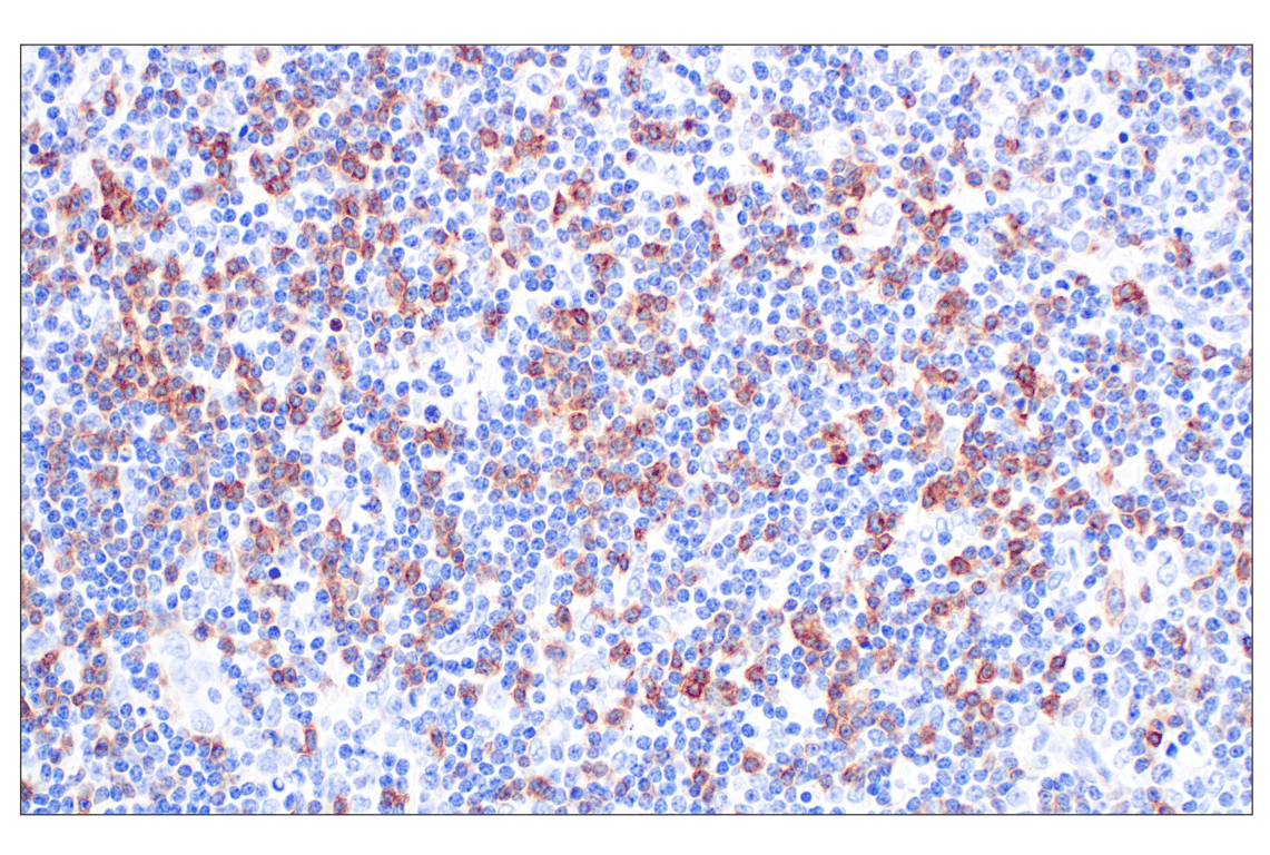 Immunohistochemistry Image 8: CCR4 (F9A9K) Rabbit Monoclonal Antibody