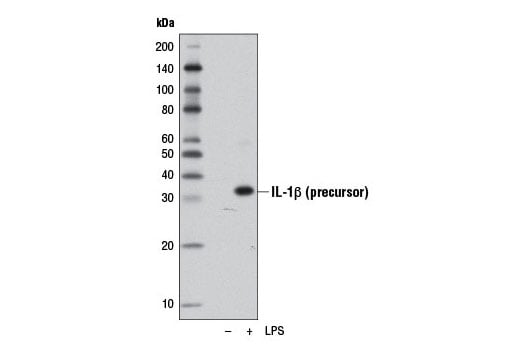 Western Blotting Image 1: IL-1 beta (D4T2D) Rabbit Monoclonal Antibody