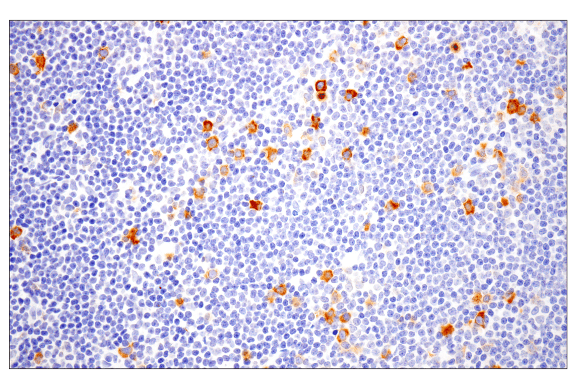Immunohistochemistry Image 4: Eg5 (E1L3W) Rabbit Monoclonal Antibody