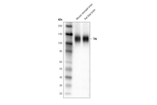 Western Blotting Image 2: TrK (pan) (A7H6R) Rabbit Monoclonal Antibody (Biotinylated)