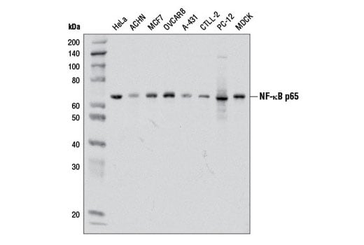 Western Blotting Image 1: NF-kappaB p65 (D14E12) Rabbit Monoclonal Antibody