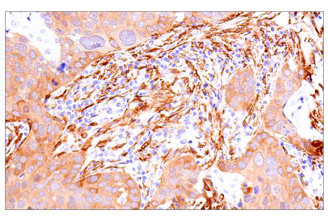 Immunohistochemistry Image 2: Phospho-YAP (Ser61) (E4Q8S) Rabbit Monoclonal Antibody