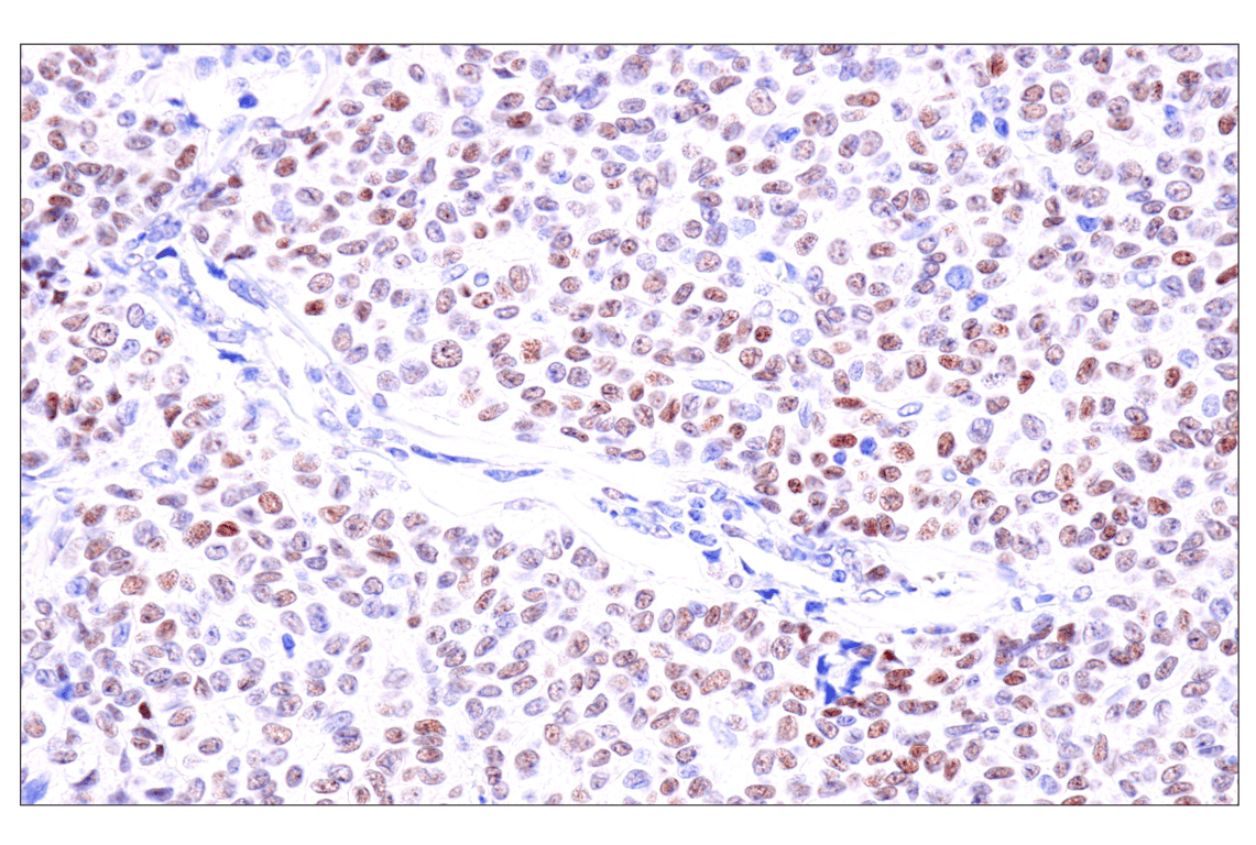 Immunohistochemistry Image 2: GATA-6 (D61E4) Rabbit Monoclonal Antibody