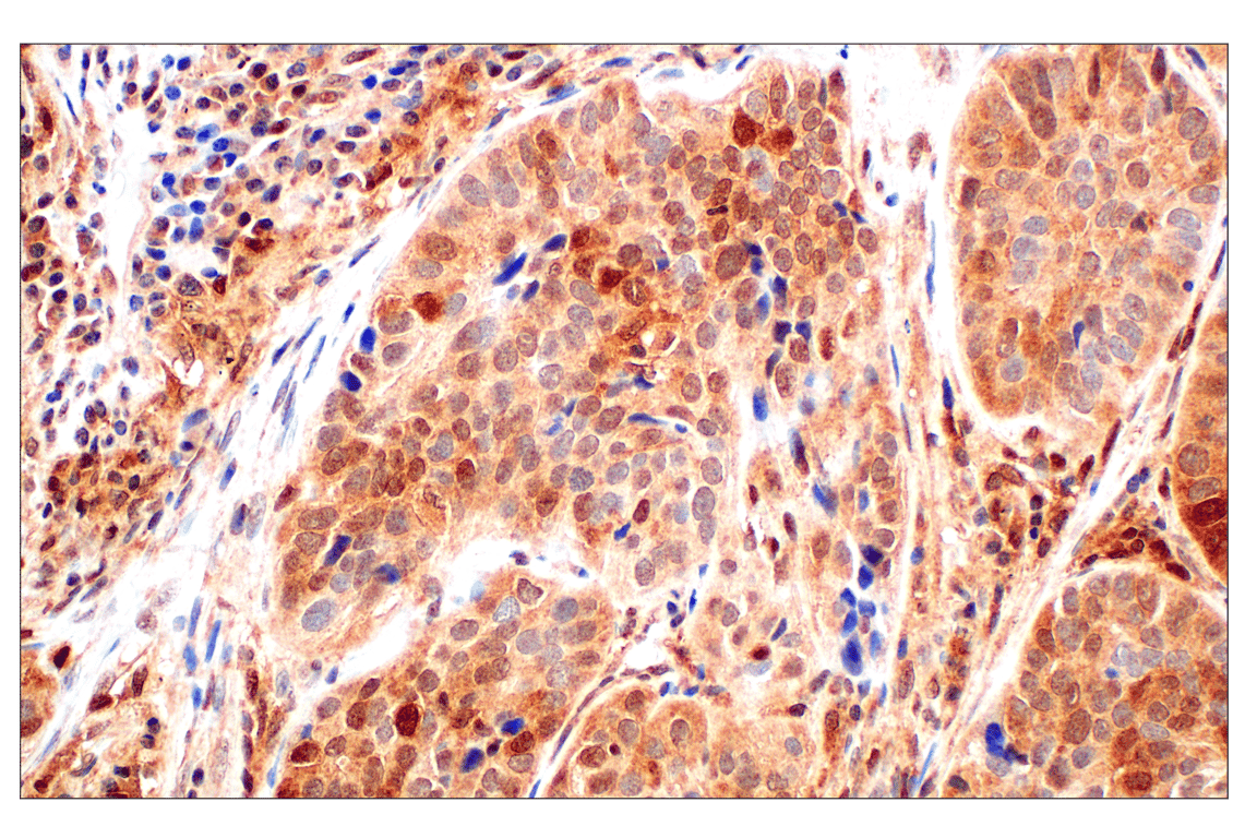 Immunohistochemistry Image 2: Stat3 (124H6) Mouse Monoclonal Antibody (BSA and Azide Free)