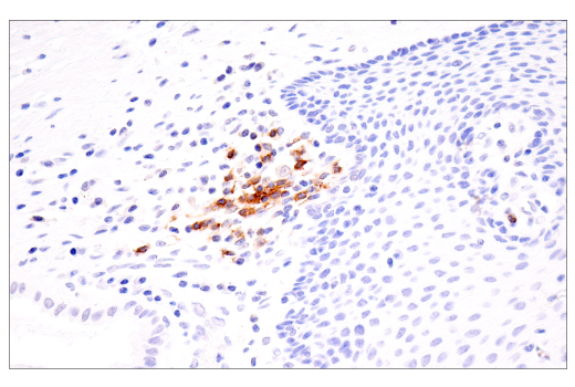 Immunohistochemistry Image 3: TNFRSF13C/BAFF-R (E3C1Q) Rabbit Monoclonal Antibody