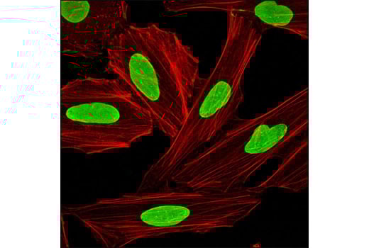 Immunofluorescence Image 1: Lamin A/C (4C11) Mouse Monoclonal Antibody (BSA and Azide Free)