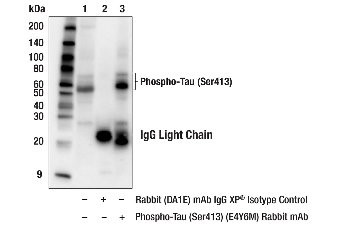 Immunoprecipitation Image 1: Phospho-Tau (Ser413) (E4Y6M) Rabbit Monoclonal Antibody