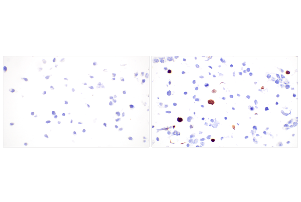 Immunohistochemistry Image 9: Citrullinated Histone H3 (Arg2) (F3C9B) Rabbit Monoclonal Antibody (BSA and Azide Free)