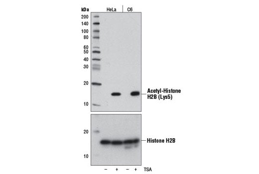 Western Blotting Image 1: Acetyl-Histone H2B (Lys5) (D5H1S) XP<sup>®</sup> Rabbit mAb (BSA and Azide Free)