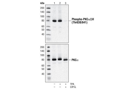 Western Blotting Image 2: Phospho-PKC alpha/beta II (Thr638/641) Antibody