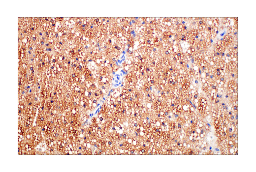 Immunohistochemistry Image 4: SCD1 (C12H5) Rabbit Monoclonal Antibody