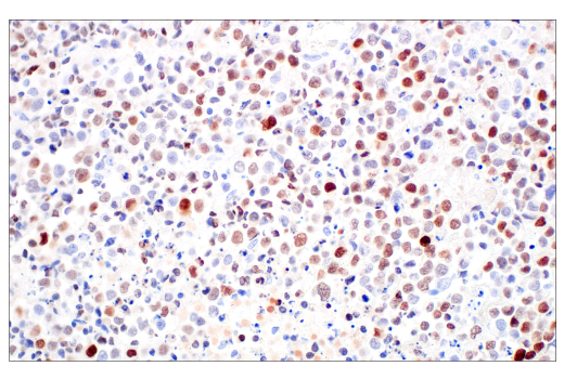 Immunohistochemistry Image 4: POU2F3 (E5N2D) Rabbit Monoclonal Antibody