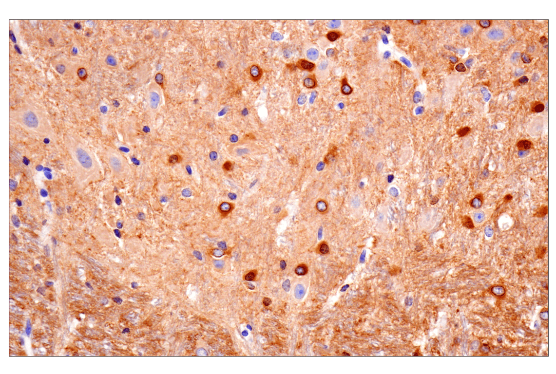 Immunohistochemistry Image 11: Phospho-Tau (Ser396) (F3S9T) Rabbit Monoclonal Antibody