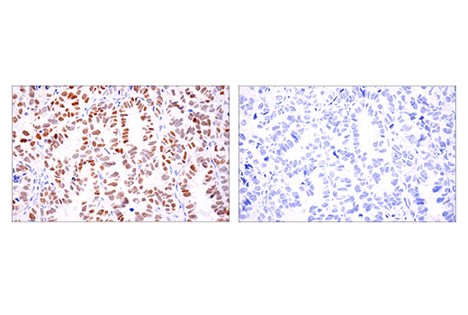 Immunohistochemistry Image 5: Phospho-Chk2 (Thr68) (E8Q1A) Rabbit Monoclonal Antibody (BSA and Azide Free)
