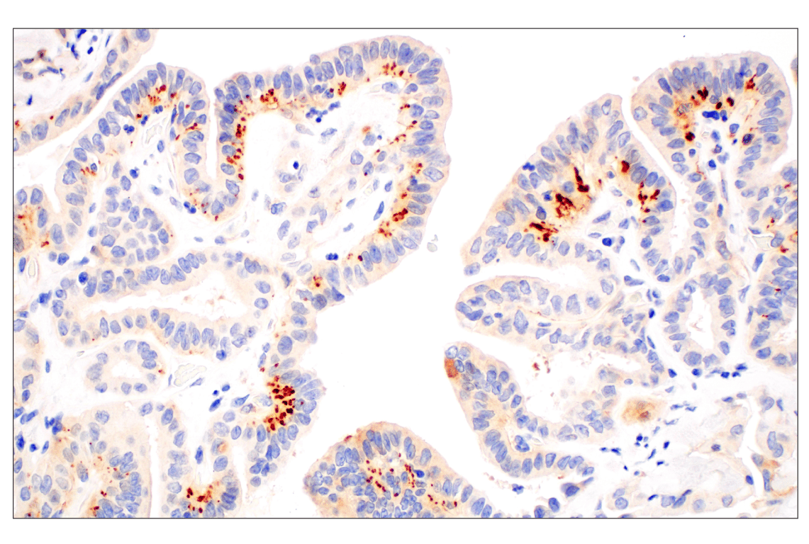 Immunohistochemistry Image 3: IL-13RA2/CD213a2 (E7U7B) Rabbit Monoclonal Antibody (BSA and Azide Free)