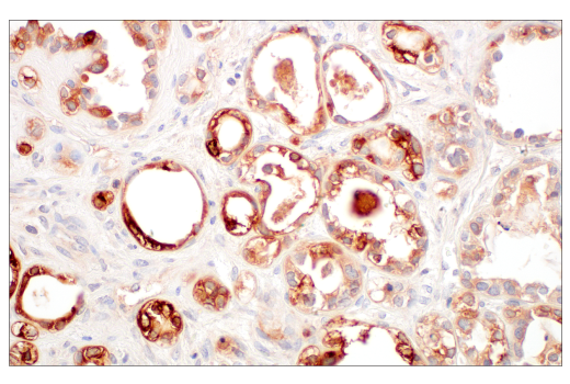 Immunohistochemistry Image 3: LCN2 (D4M8L) Rabbit Monoclonal Antibody