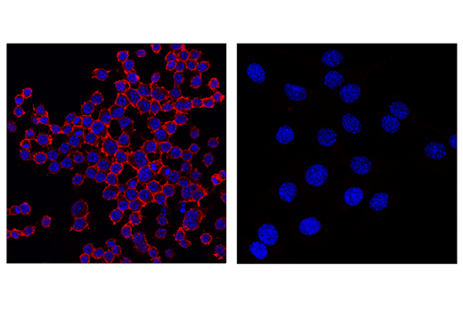 cd45枚 CD45 (D3F8Q) Rabbit mAb (Alexa Fluor® 594 Conjugate) | Cell