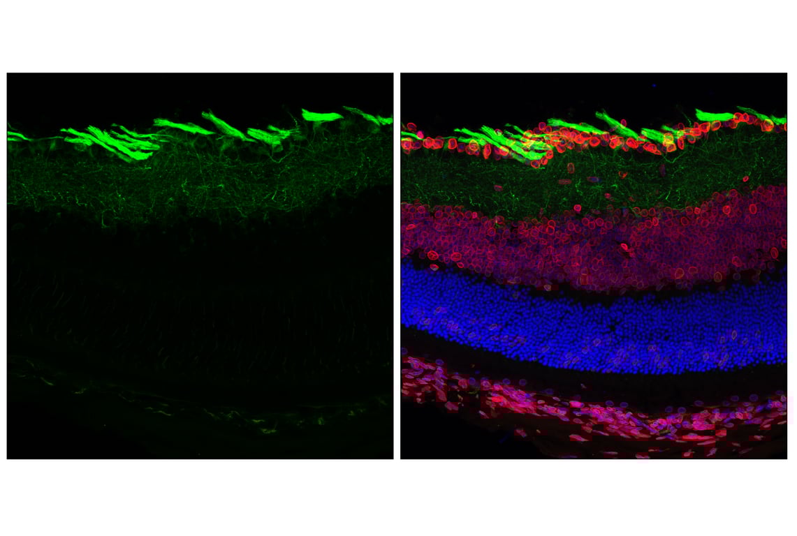 Immunofluorescence Image 1: beta3-Tubulin (E9F3E) Mouse Monoclonal Antibody (BSA and Azide Free)