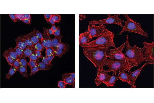 Immunofluorescence Image 1: FAM3C (D1S2D) XP<sup>®</sup> Rabbit mAb