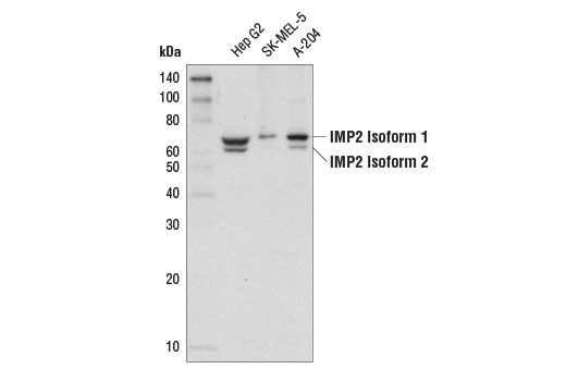 Western Blotting Image 1: IMP2 (D4R2F) Rabbit mAb