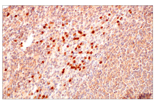 undefined Image 21: Gluconeogenesis Antibody Sampler Kit