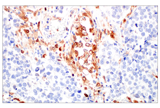 Immunohistochemistry Image 4: HO-1 (E8B7A) XP<sup>®</sup> Rabbit mAb (BSA and Azide Free)