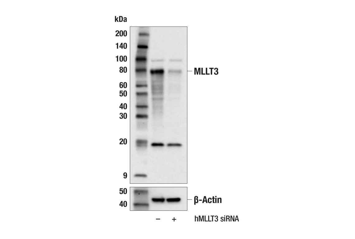 Western Blotting Image 2: MLLT3 (E5Z7U) Rabbit Monoclonal Antibody
