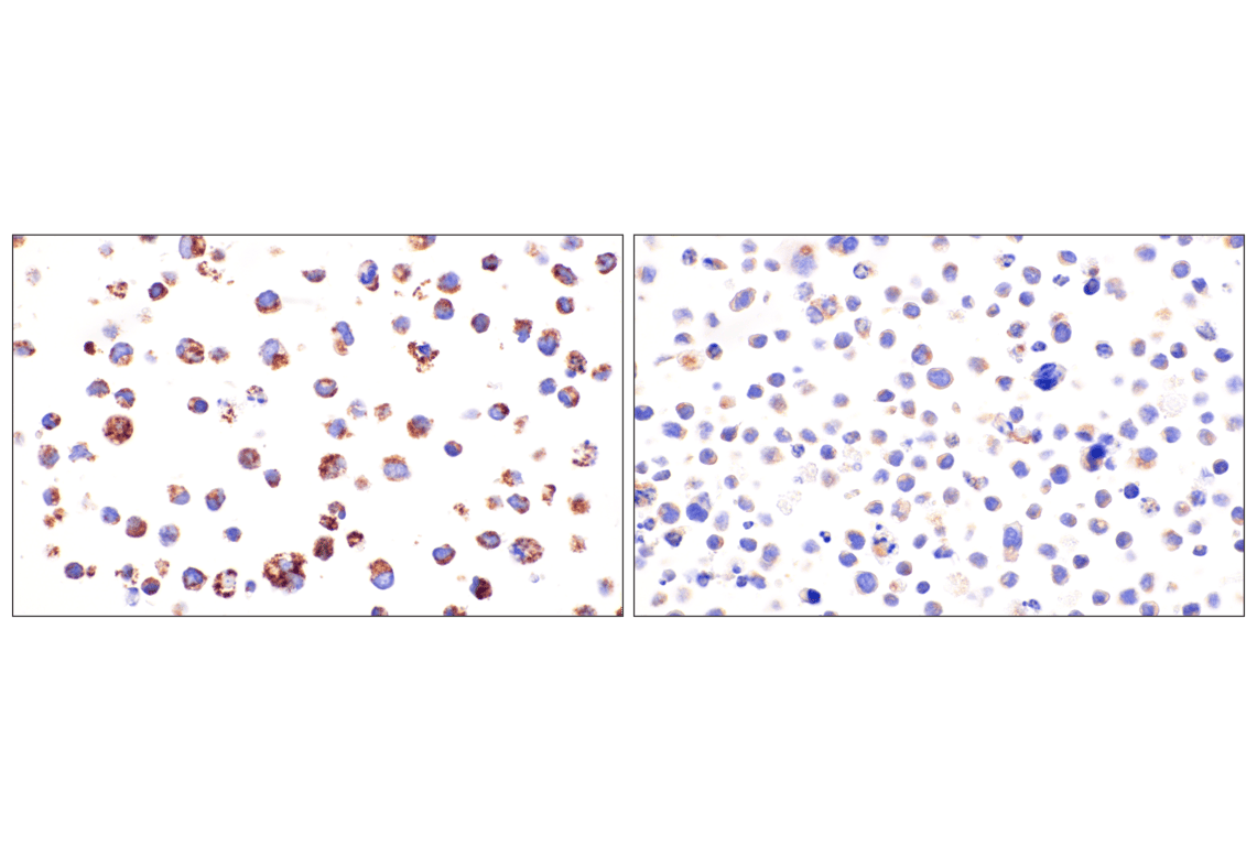 Immunohistochemistry Image 16: SLC25A1 (E7B2B) Rabbit Monoclonal Antibody