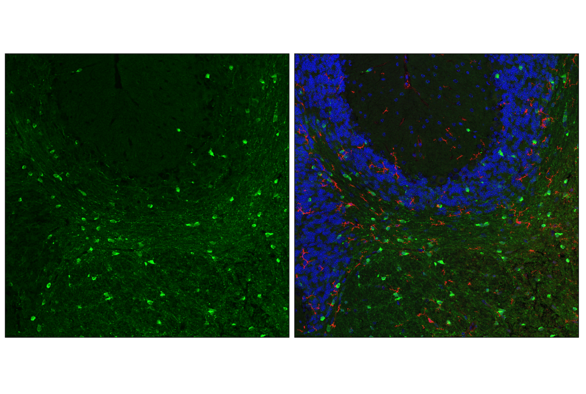 Immunofluorescence Image 2: TPPP/p25 (E9C8G) Rabbit Monoclonal Antibody