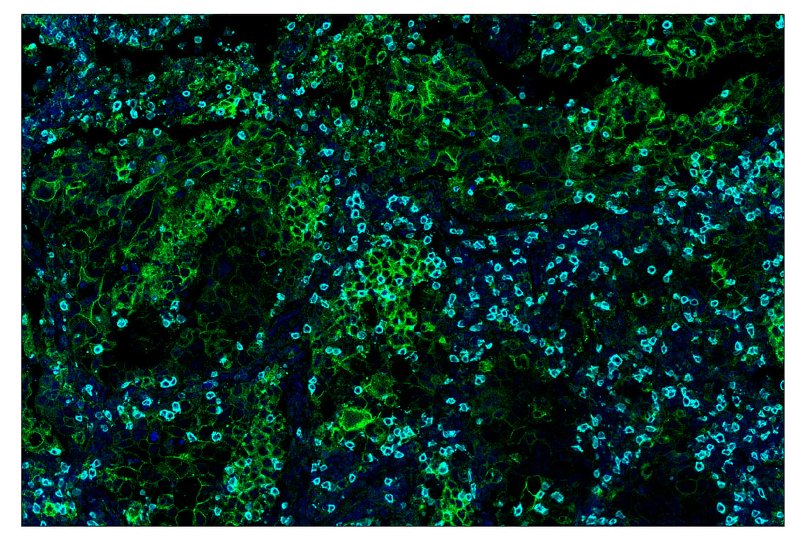 Immunohistochemistry Image 1: PD-L1 (E1L3N<sup>®</sup>) & CO-0005-647 SignalStar<sup>™</sup> Oligo-Antibody Pair