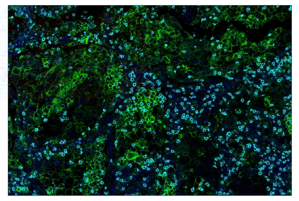 Immunohistochemistry Image 1: PD-L1 (E1L3N<sup>®</sup>) & CO-0005-594 SignalStar<sup>™</sup> Oligo-Antibody Pair