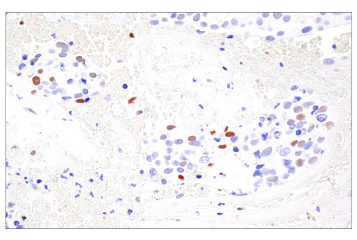 Immunohistochemistry Image 3: HIF-1 alpha (E1V6A) Rabbit Monoclonal Antibody (BSA and Azide Free)