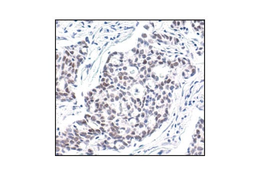 undefined Image 13: Phospho-SAPK/JNK Pathway Antibody Sampler Kit