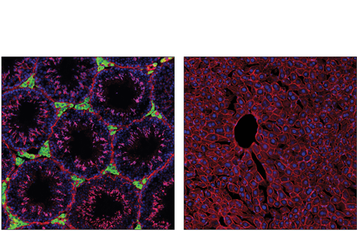 Immunofluorescence Image 1: CYP17A1 (E6A7G) Rabbit Monoclonal Antibody