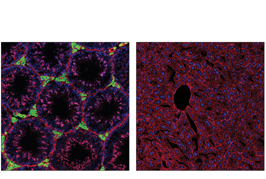 Immunofluorescence Image 1: CYP17A1 (E6A7G) XP<sup>®</sup> Rabbit mAb