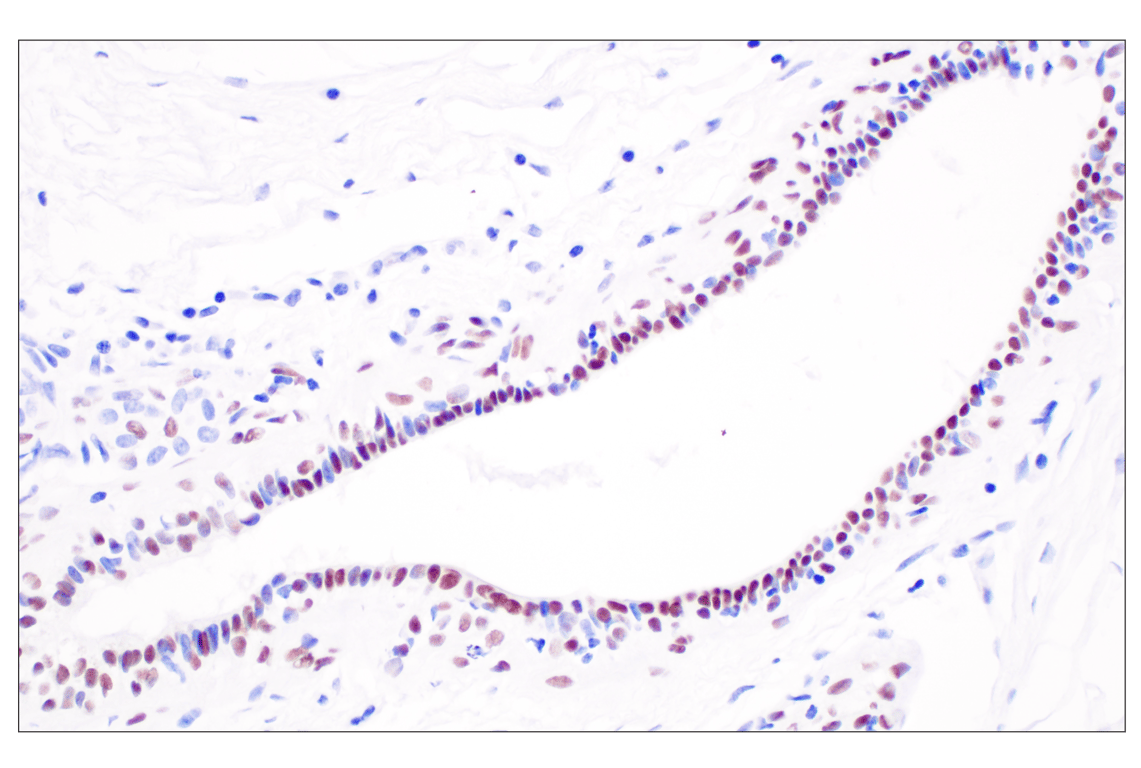 Immunohistochemistry Image 5: Sox10 (E2V9N) Rabbit Monoclonal Antibody (BSA and Azide Free)