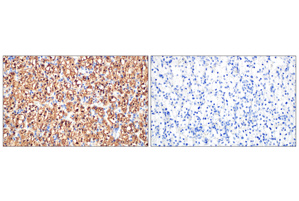 Immunohistochemistry Image 15: Perilipin-2 (E6G6M) Rabbit Monoclonal Antibody
