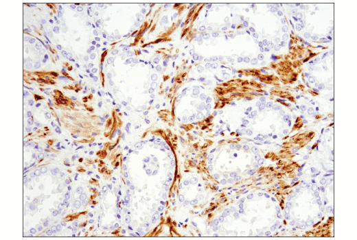 Immunohistochemistry Image 3: OX40L (D6K7R) Rabbit Monoclonal Antibody