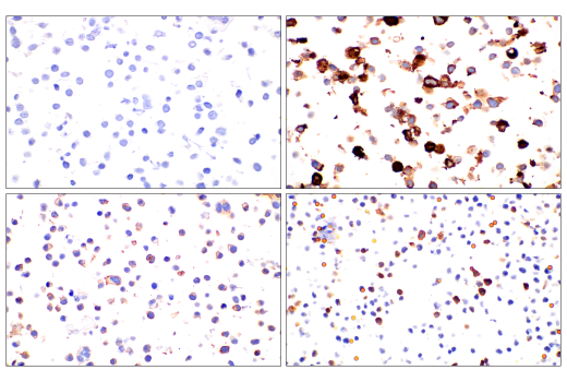 Immunohistochemistry Image 9: TIGIT (E5Y1W) Rabbit Monoclonal Antibody (BSA and Azide Free)