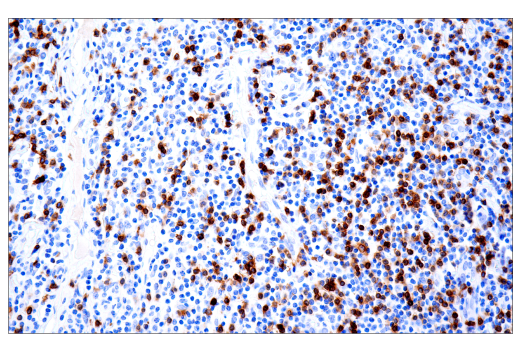 Immunohistochemistry Image 9: TRBC1/TCR beta constant region 1 (E6Z3S) Rabbit Monoclonal Antibody