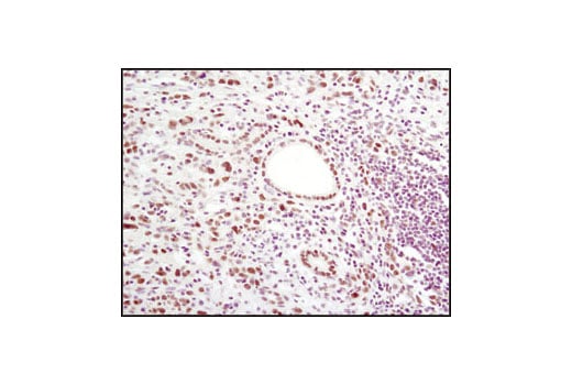 Immunohistochemistry Image 3: LSD1 (C69G12) Rabbit Monoclonal Antibody (BSA and Azide Free)