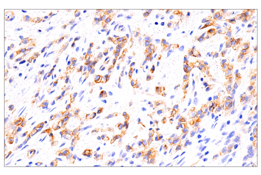 Immunohistochemistry Image 2: DOG1/Anoctamin 1 (K9) Mouse Monoclonal Antibody