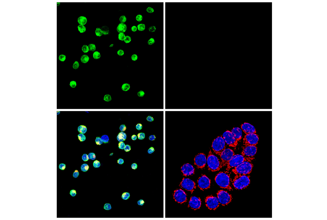 Immunofluorescence Image 1: Bcl-2 (124) Mouse Monoclonal Antibody (BSA and Azide Free)