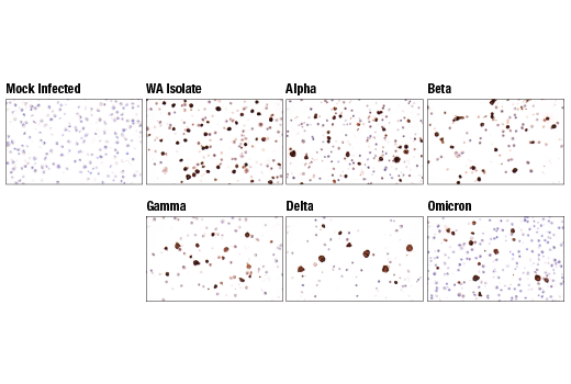 Immunohistochemistry Image 5: SARS-CoV-2 Nucleocapsid Protein (HL344) Rabbit Monoclonal Antibody