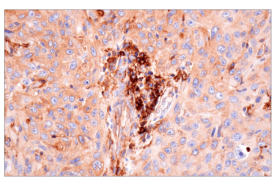 Immunohistochemistry Image 4: HLA-B (BC43) Mouse Monoclonal Antibody