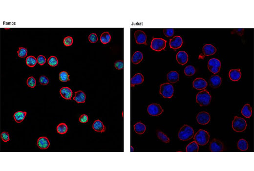 Immunofluorescence Image 1: PAX5 (D19F8) XP<sup>®</sup> Rabbit mAb