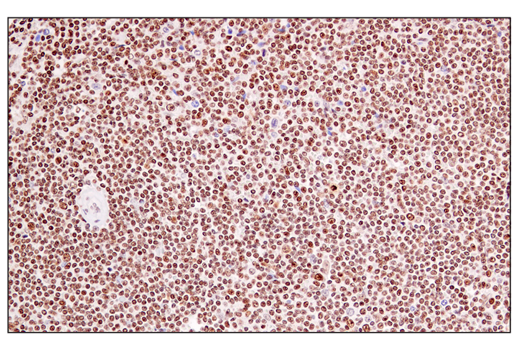 Immunohistochemistry Image 3: DEK (E4S5J) Rabbit Monoclonal Antibody