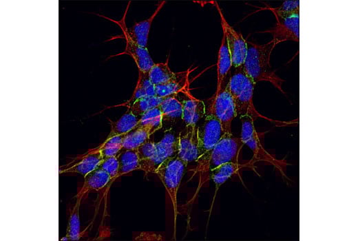 Immunofluorescence Image 1: alpha-N-Catenin Antibody